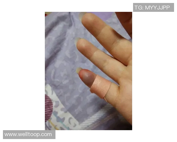 阿伦手指伤势轻微并非之前骨折的部位影响恢复进程 阿伦手指伤势轻微并非之前骨折的部位影响恢复进程